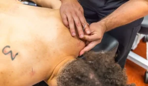 Sports Medicine Acupuncture being applied to athlete’s shoulder to reduce pain and support movement recovery