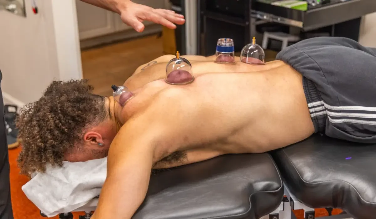 Active cupping therapy performed on athlete’s back to support muscle recovery and reduce post-workout tension.